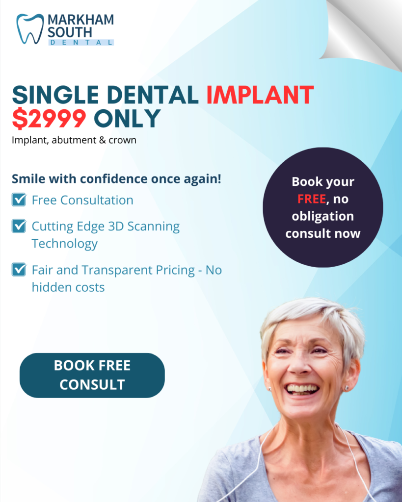 cheap dental implant offer in Markham